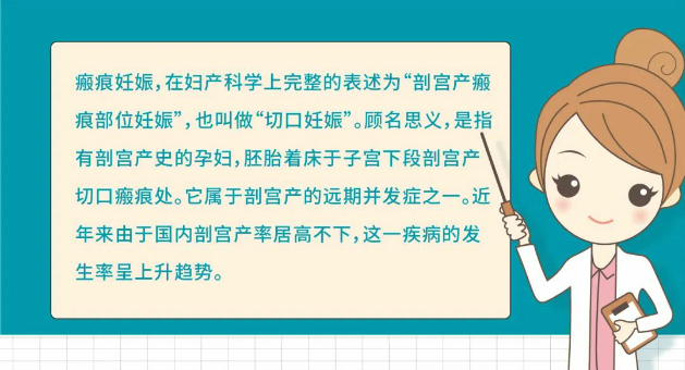 怀孕13周发现瘢痕妊娠！安琪儿妇科团队为她拆除身体里的这颗“定时炸弹”