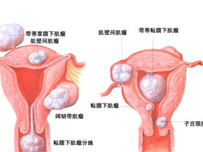 恶性肿瘤要怎么检查