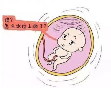 你的羊水为什么比别人多？！前方为你发来一份健康“预警”